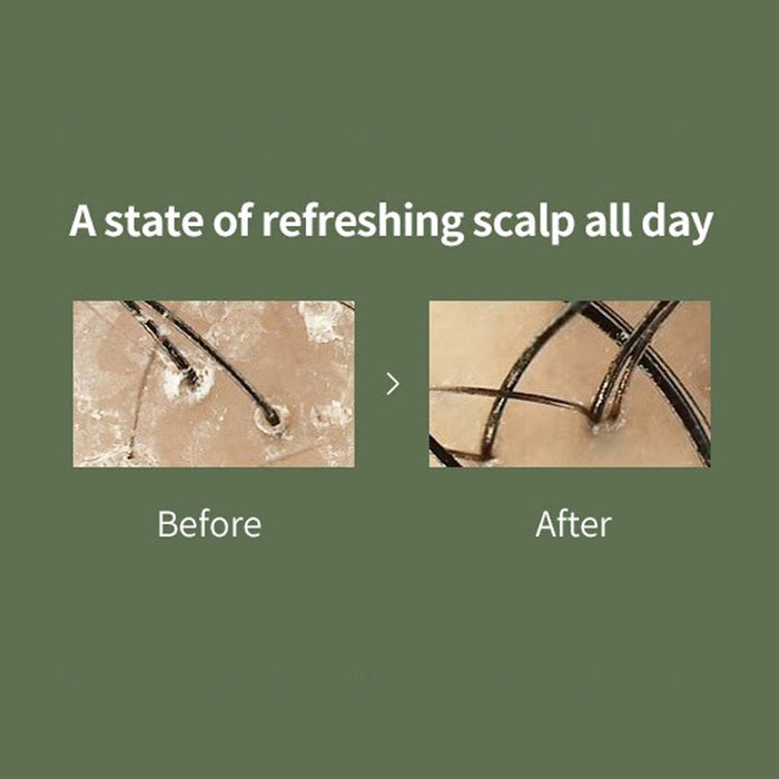 LADOR Scalp Scaling Spa Ampoule