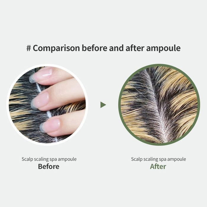 LADOR Scalp Scaling Spa Ampoule
