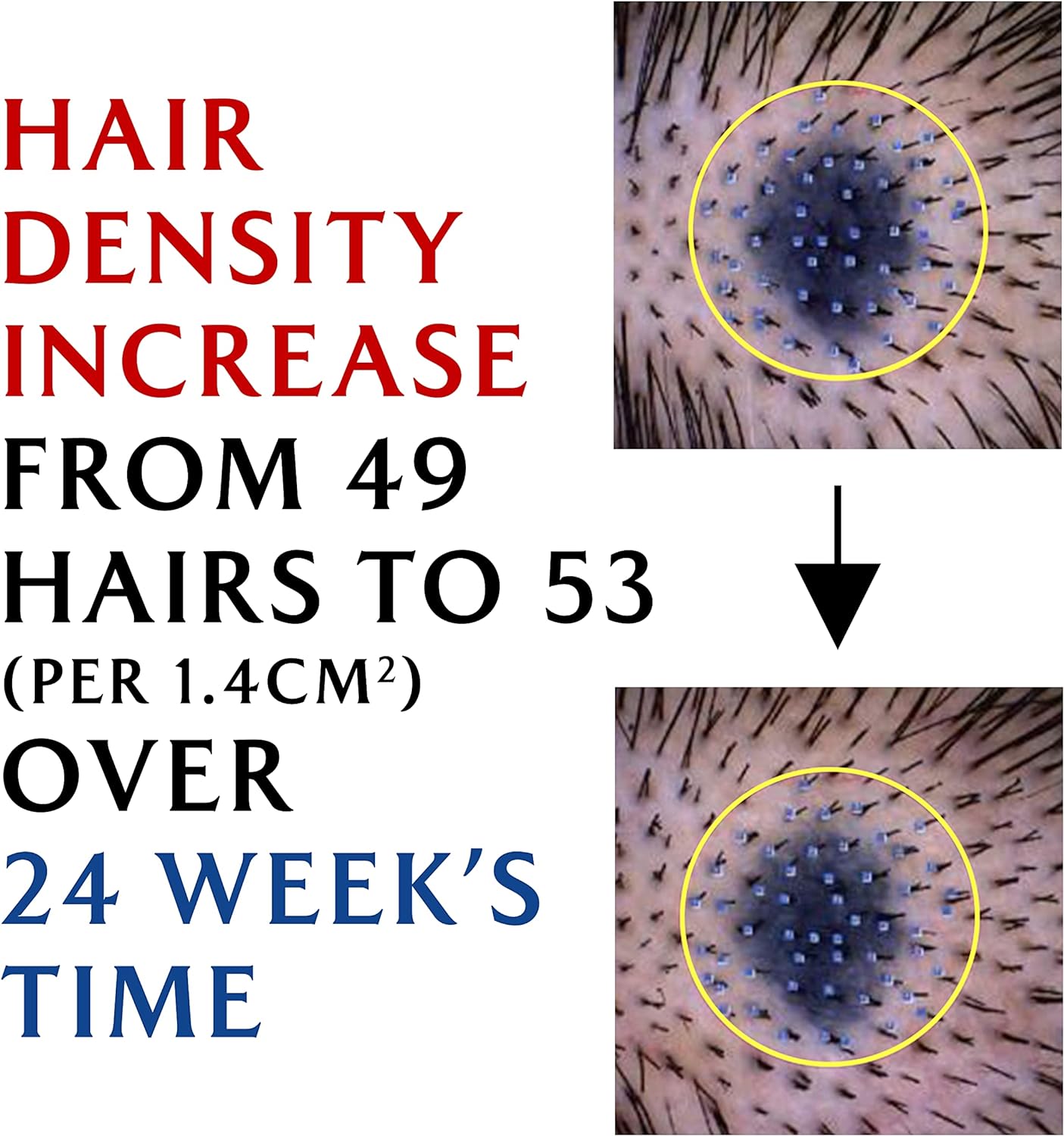 LADOR Dermatical Hair-Loss Shampoo from Lador